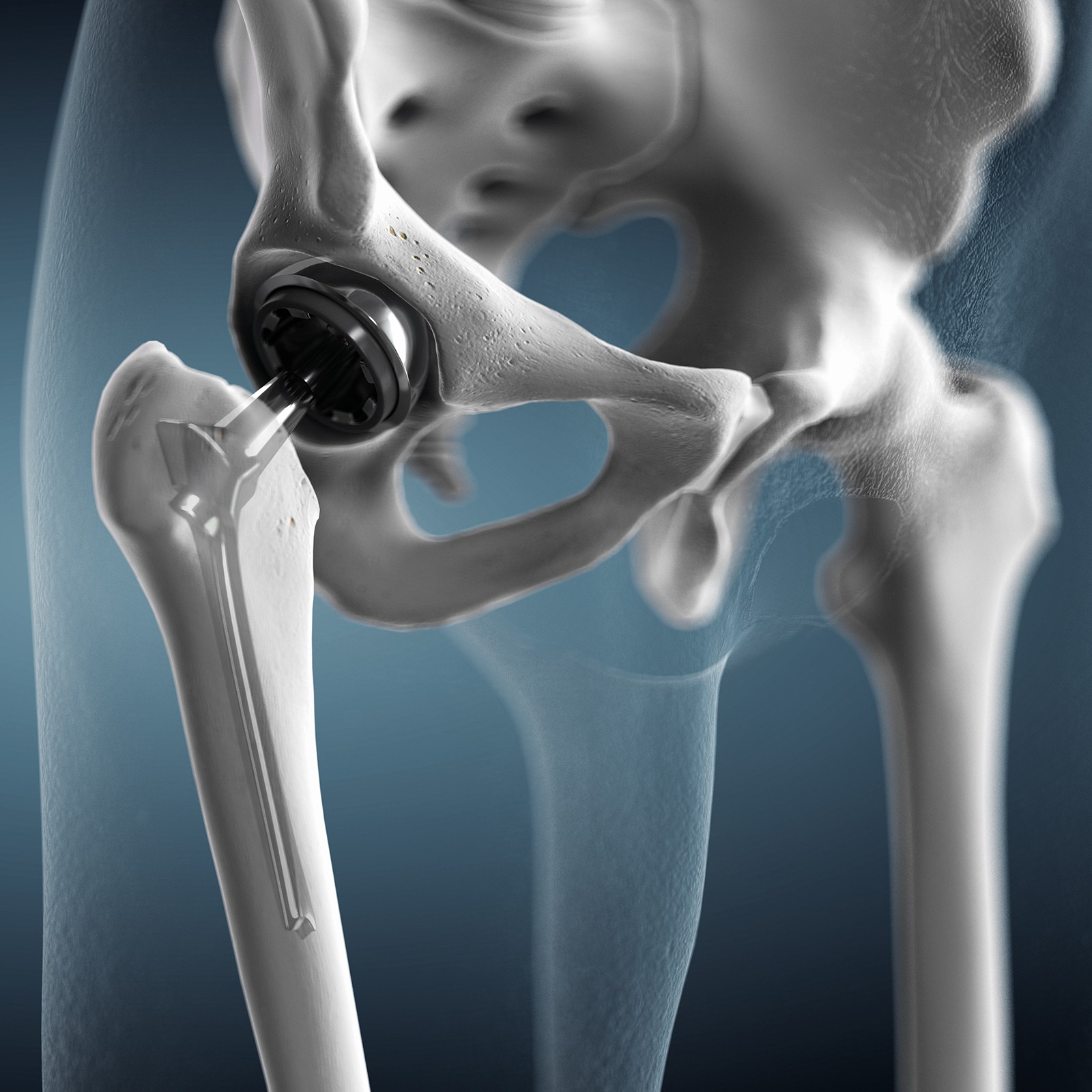 ARTIFICIAL INTELLIGENCE PROSTHETICS visual data 6